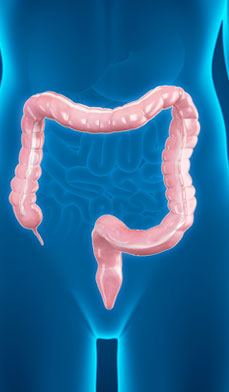 Benign Colorectal