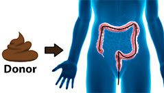 Faecal Microbiota Transplant (FMT)